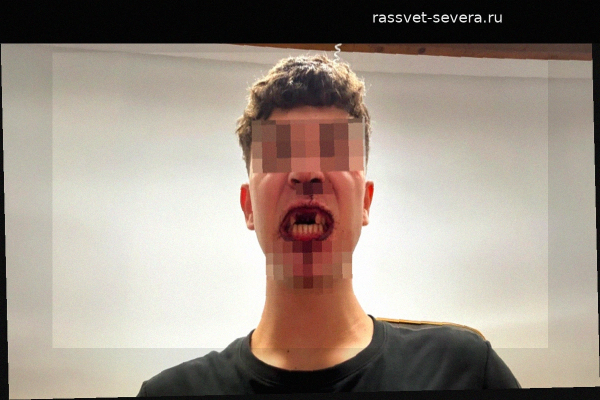 16-летний Игнасио стал жертвой жестокого нападения на Майорке: «Я лишился зубов и даже не успел ничего понять»