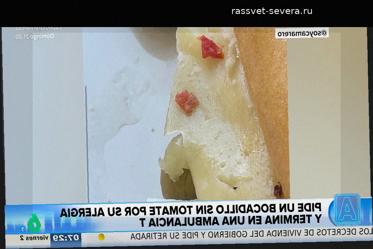 Ошибка персонала бара едва не стоила жизни клиентке с аллергией на томаты