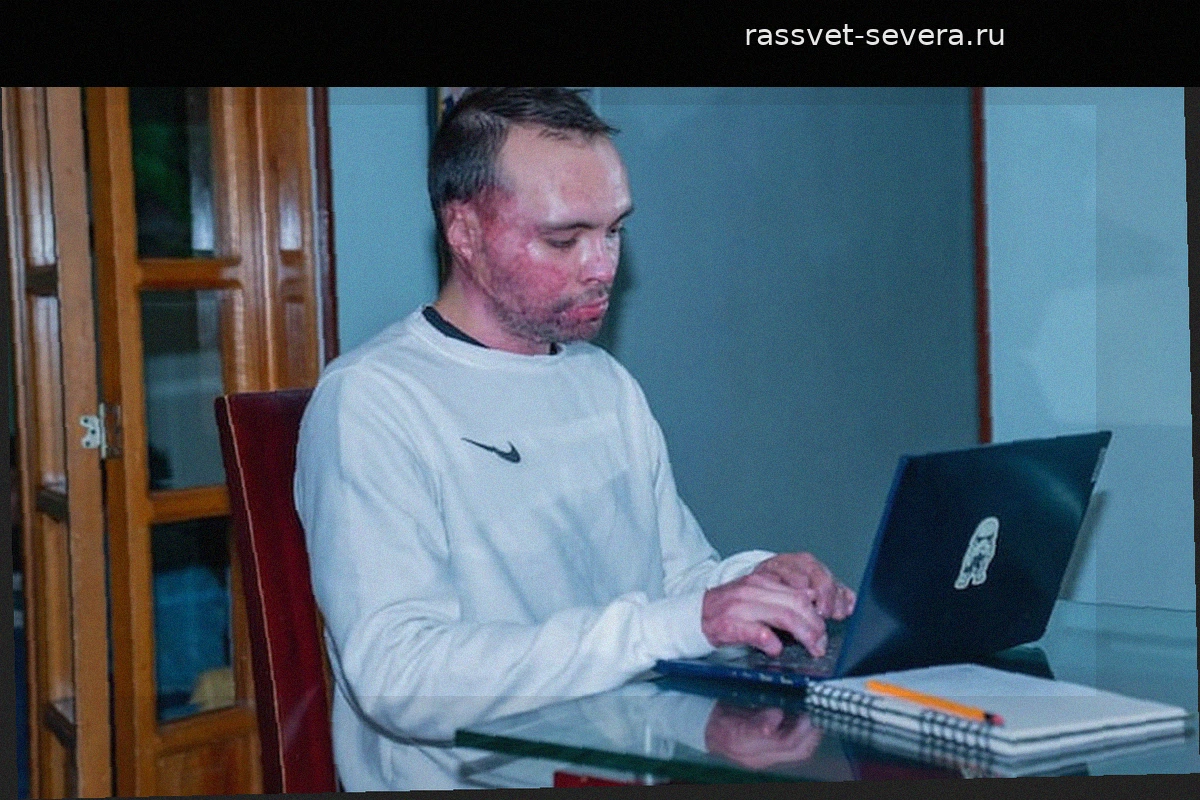 «Мечта не окончена»: Мигель Мехия стремится вернуться в армию после того, как его пытались сжечь заживо
