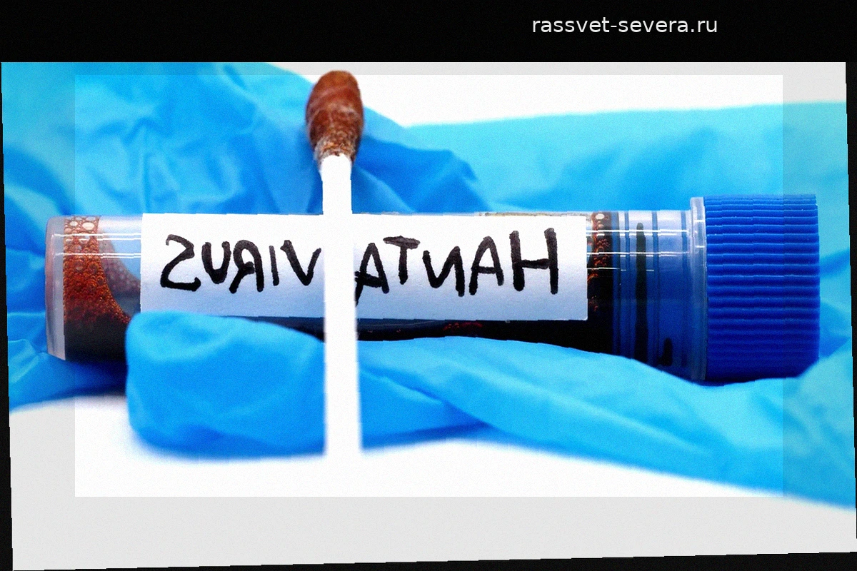 Ситуация с хантавирусом: пациентам в госпитале Гомес Улья могут разрешить свидания